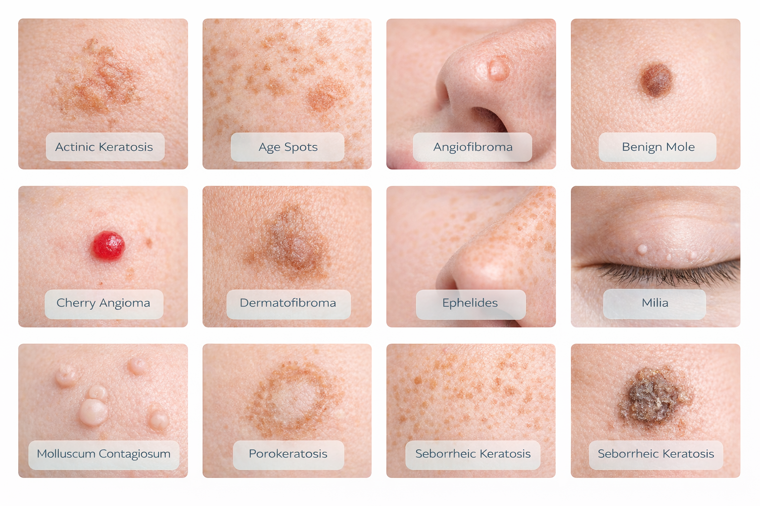 Illustration of precision in skin treatment